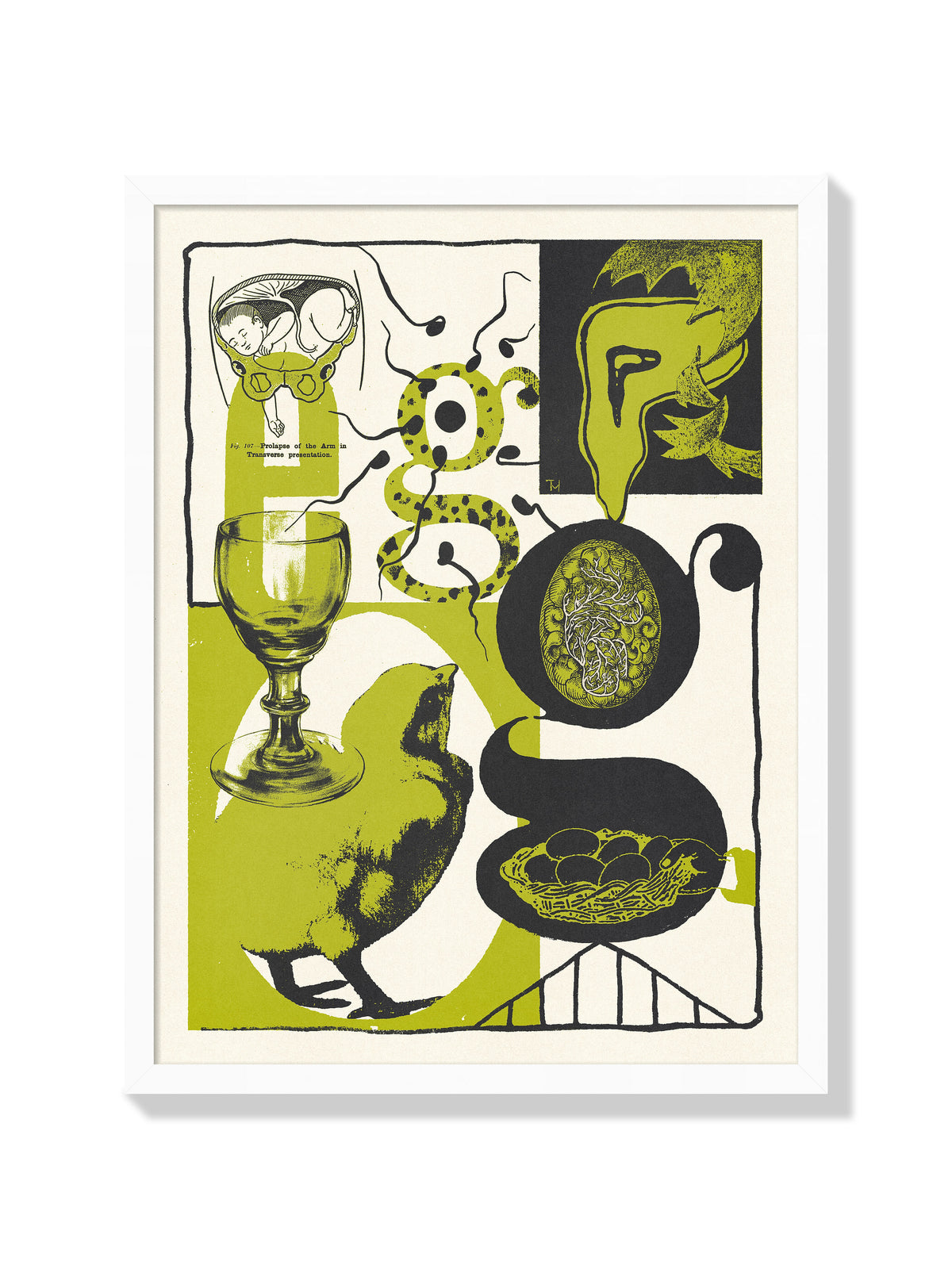 Egg - Mateus Teixeira - White Frame |frame=White Frame|