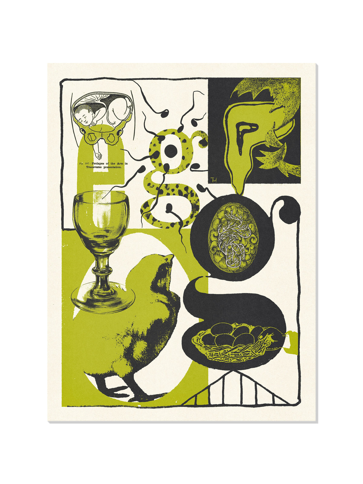 Egg - Mateus Teixeira - Unframed |frame=Unframed|