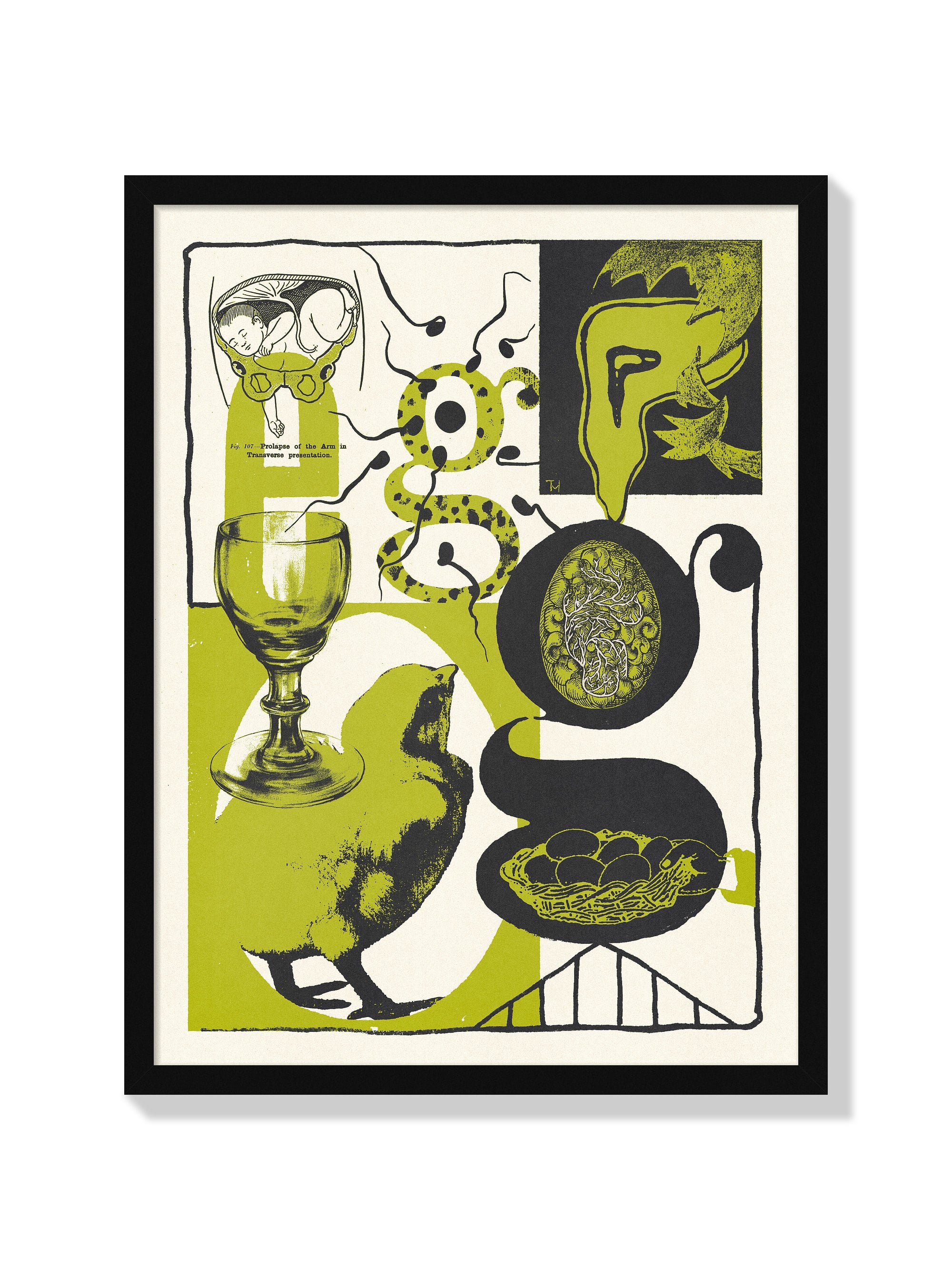 Egg - Mateus Teixeira - Black Frame |frame=Black Frame|